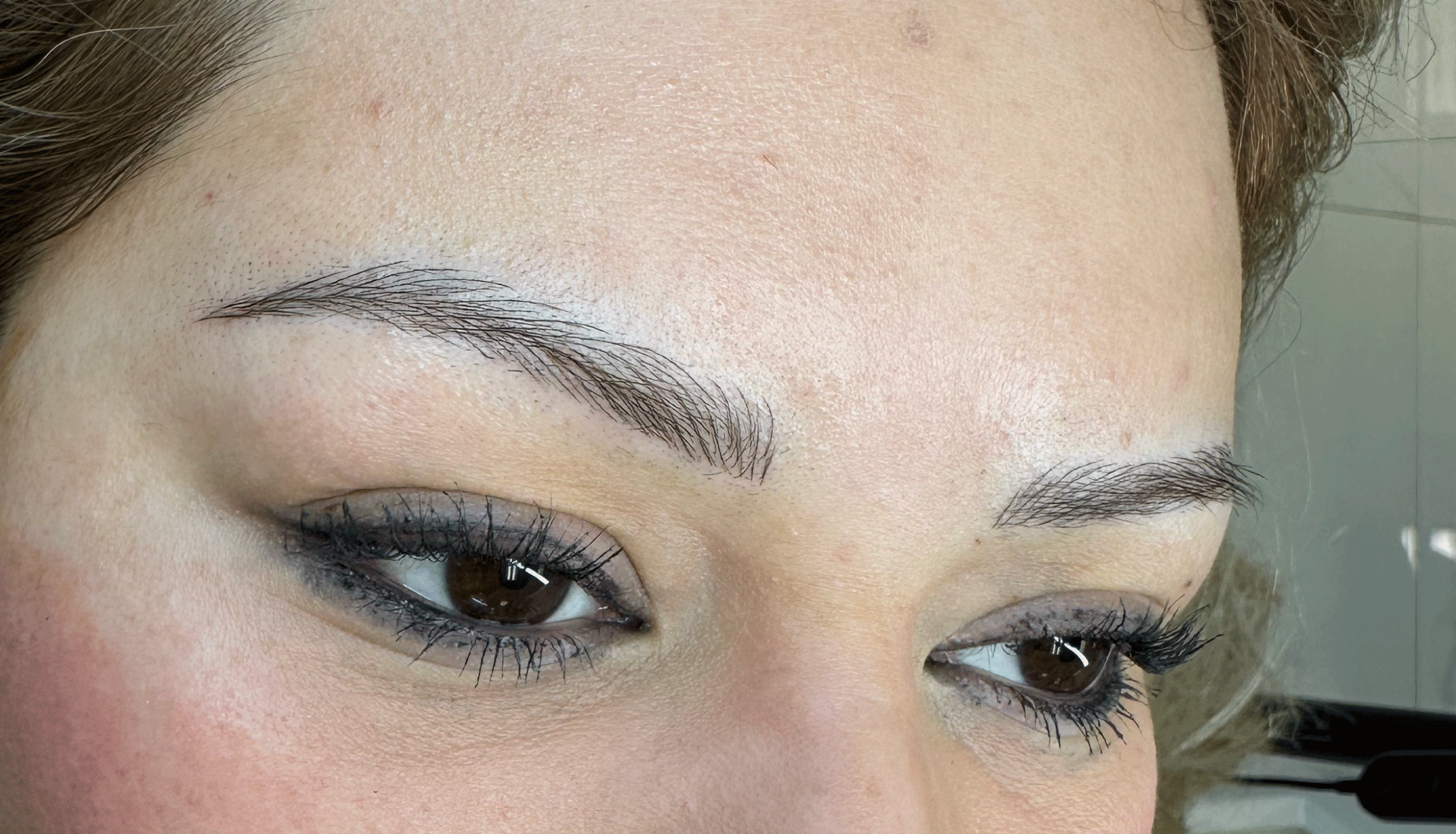 Antes-1