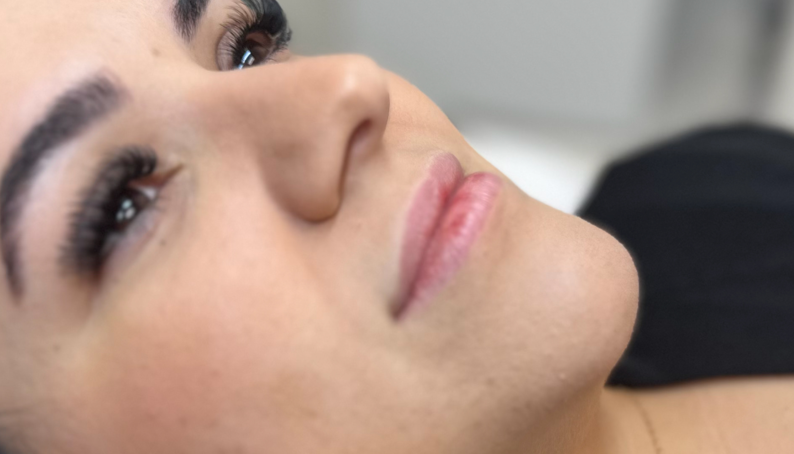 Labios-Antes