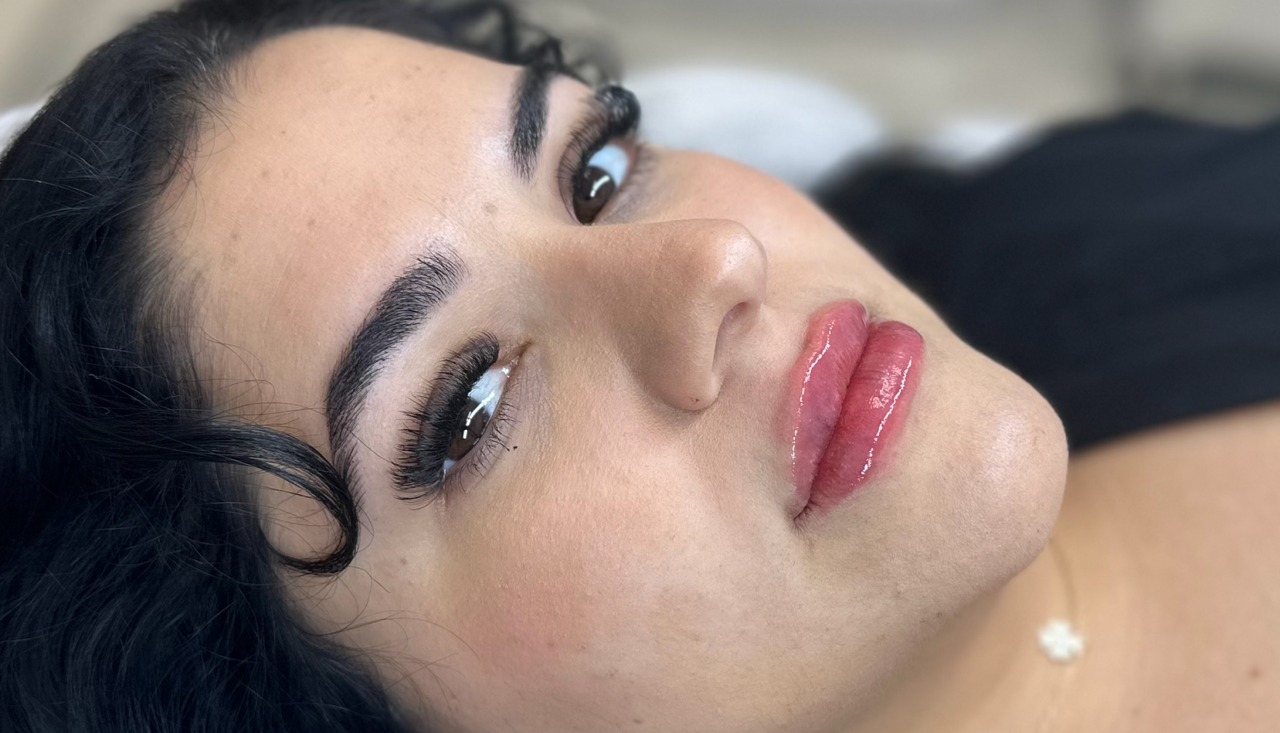 Labios-Despues