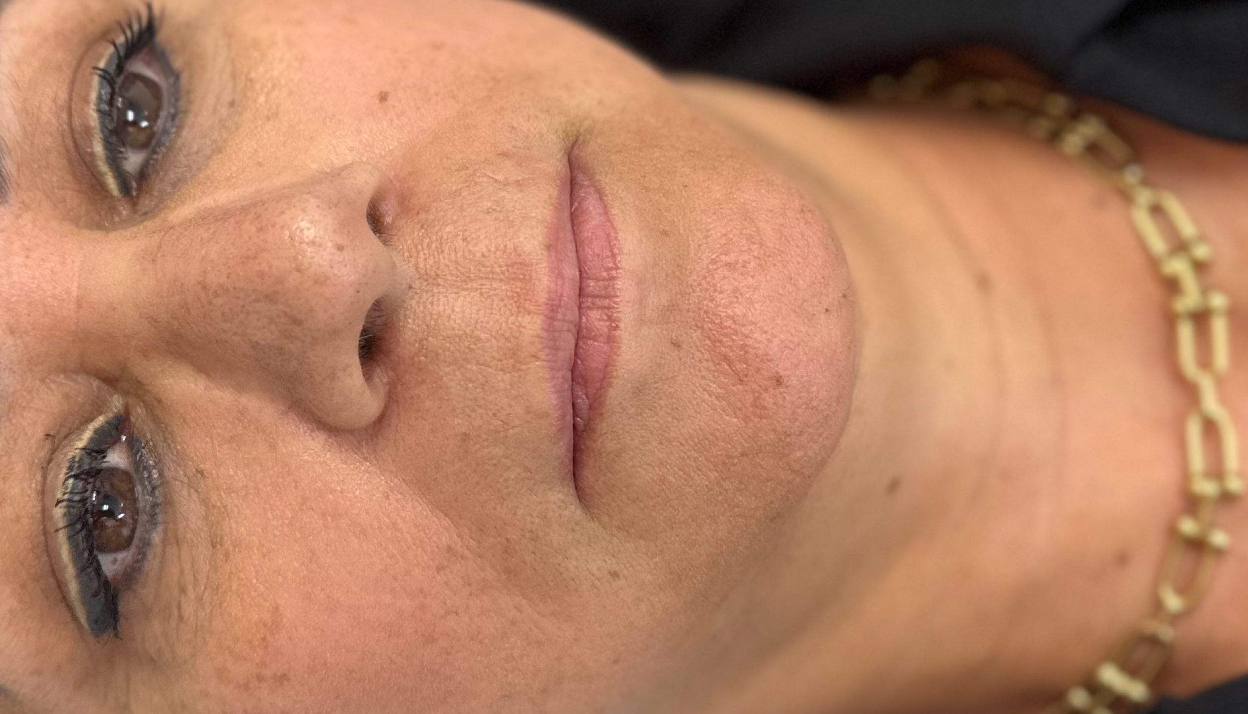 Labios-NTES-4